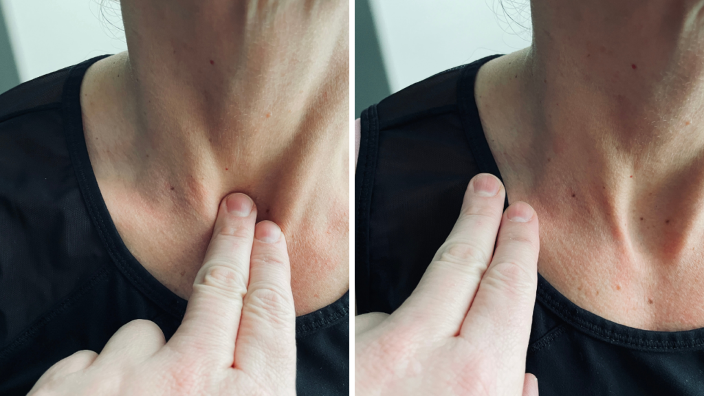 image illustrating how to find the  supraclavicular lymph nodes in the neck for lymphatic drainage massage